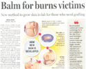 Hindustan Times - Balm for Burns Victims
