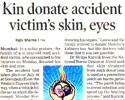 Kin donate accident victim's skin, eyes
