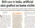 Donate skin and save life; skin bank must in Public hospitalStill rare in India, artifical skin grafted on burns victim