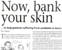 Now, bank your skin