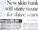 New Skin bank will store tissue for three years