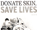 Donate skin, save lives